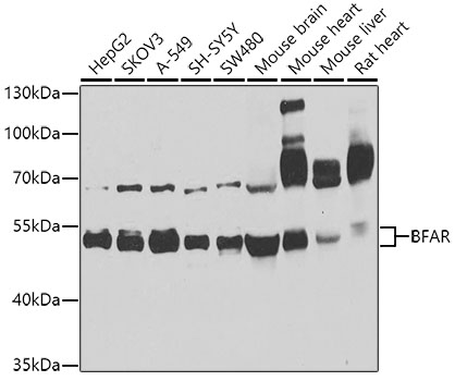 BFAR Rabbit polyclonal antibody
