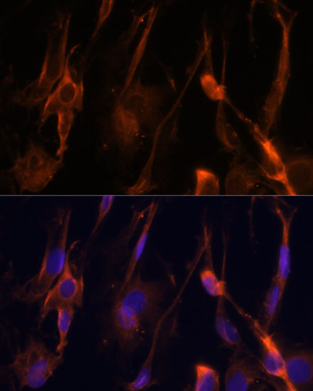 BFAR Rabbit polyclonal antibody