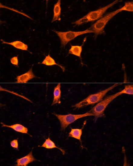 BFAR Rabbit polyclonal antibody