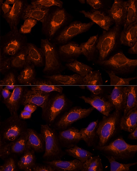 BFAR Rabbit polyclonal antibody