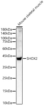 SHOX2 Rabbit polyclonal antibody