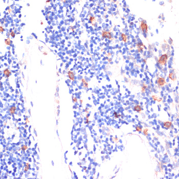 WNT5B Rabbit polyclonal antibody