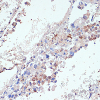 WNT5B Rabbit polyclonal antibody
