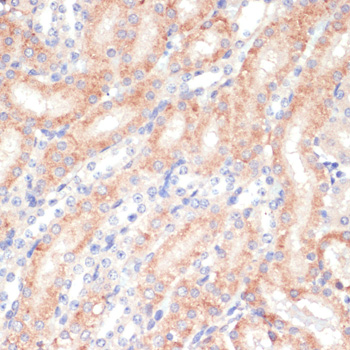 WNT5B Rabbit polyclonal antibody