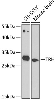 TRH Rabbit polyclonal antibody
