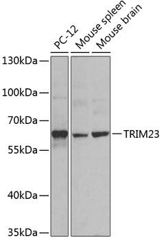 TRIM23 Rabbit polyclonal antibody