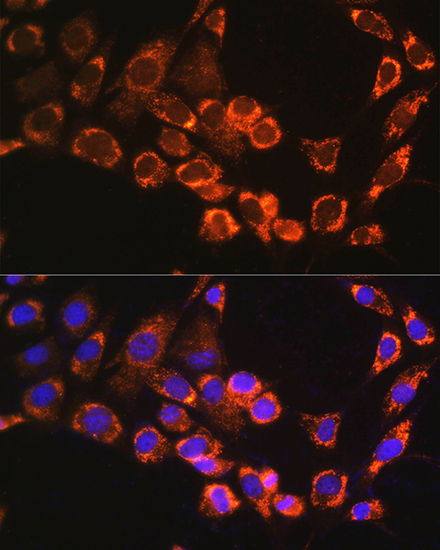 TRIM23 Rabbit polyclonal antibody