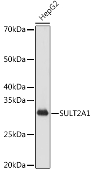 SULT2A1 Rabbit monoclonal antibody