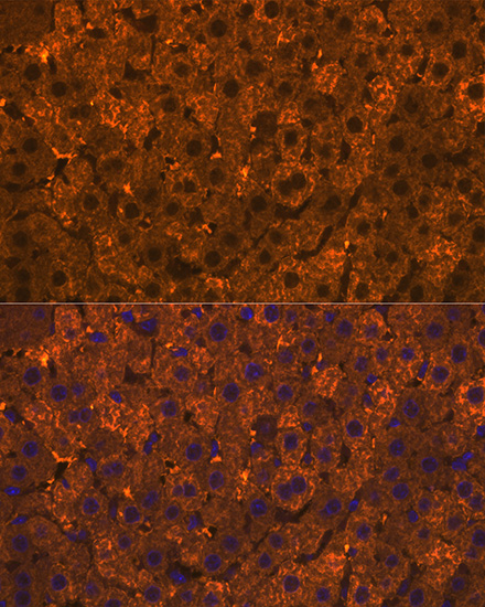 SULT2A1 Rabbit monoclonal antibody