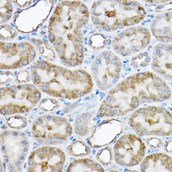 GRPEL2 Rabbit polyclonal antibody