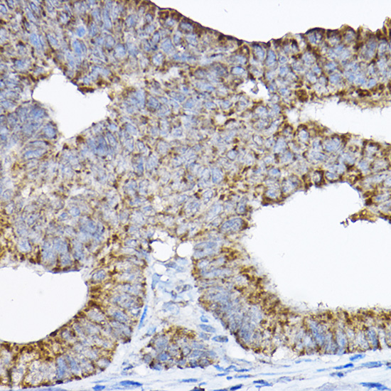 GRPEL2 Rabbit polyclonal antibody