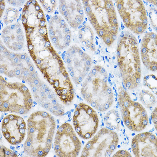 GRPEL2 Rabbit polyclonal antibody