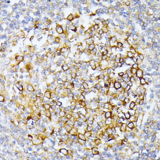 CAD Rabbit polyclonal antibody