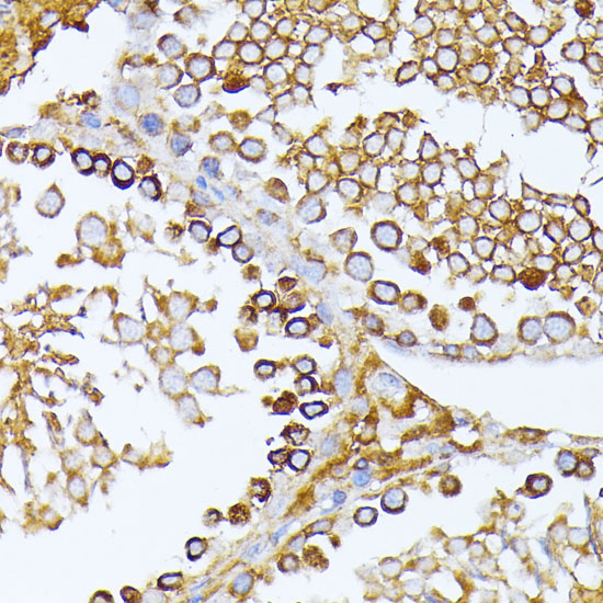 CAD Rabbit polyclonal antibody