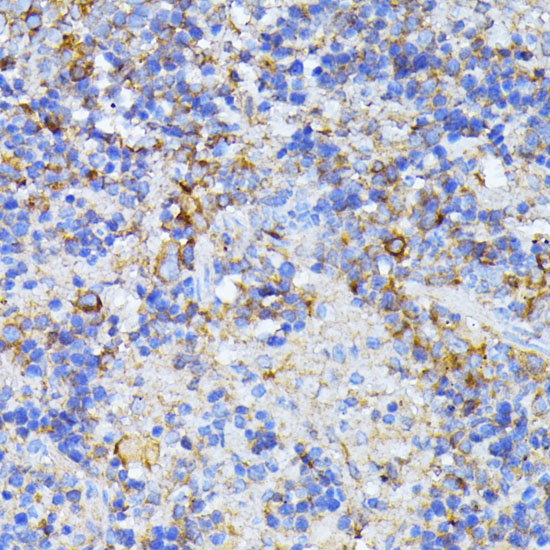 CAD Rabbit polyclonal antibody