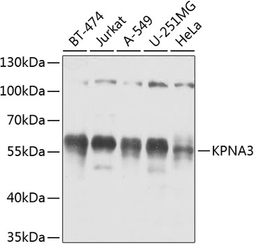 KPNA3 Rabbit polyclonal antibody