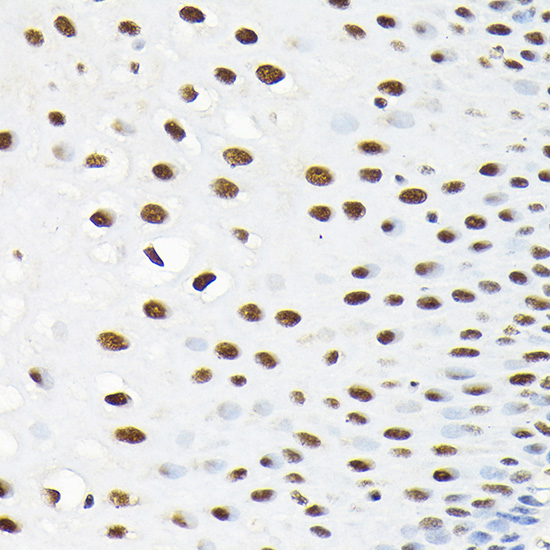 KPNA3 Rabbit polyclonal antibody