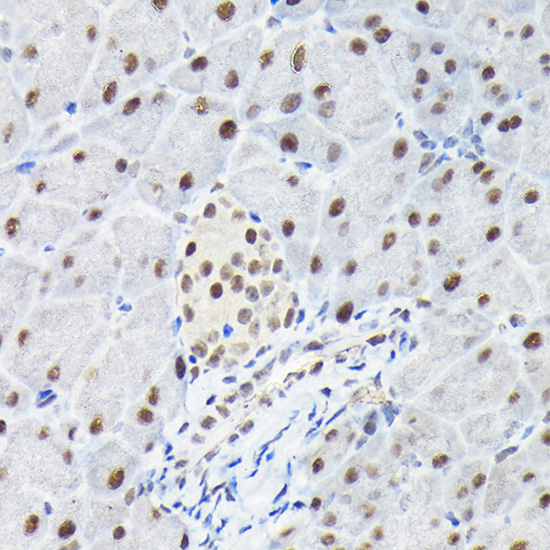 KPNA3 Rabbit polyclonal antibody