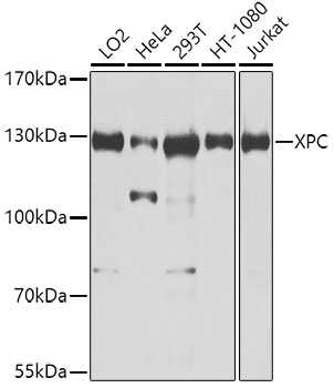 XPC Rabbit polyclonal antibody
