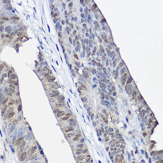 XPC Rabbit polyclonal antibody