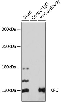 XPC Rabbit polyclonal antibody