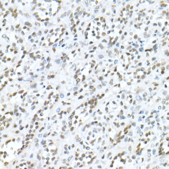 MDC1 Rabbit polyclonal antibody