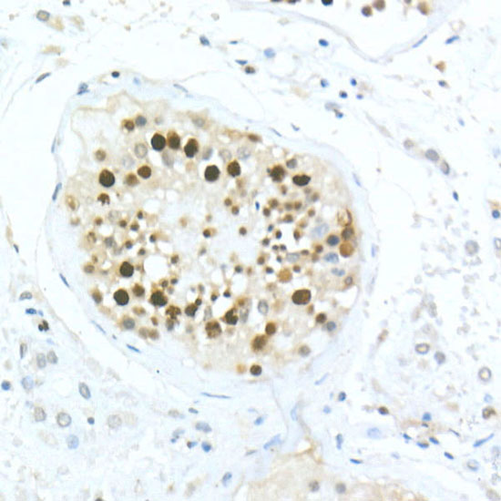 MDC1 Rabbit polyclonal antibody