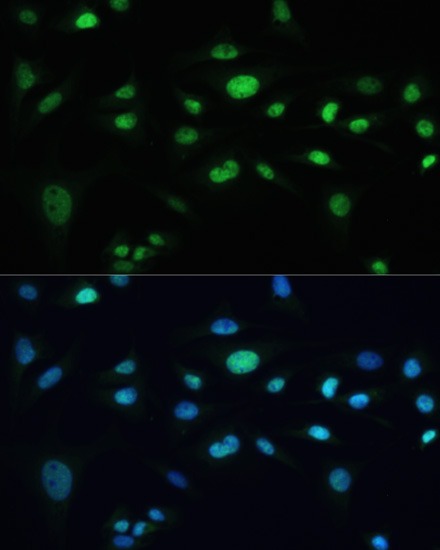 MDC1 Rabbit polyclonal antibody