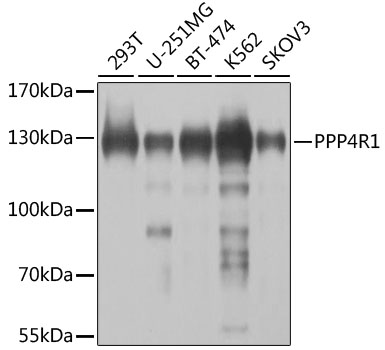 PPP4R1 Rabbit polyclonal antibody