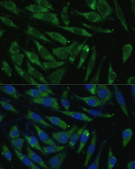 PITRM1 Rabbit polyclonal antibody