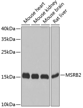 MSRB2 Rabbit polyclonal antibody