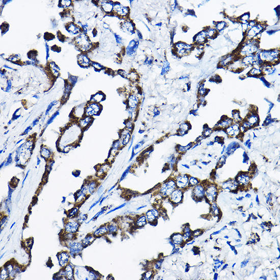 MSRB2 Rabbit polyclonal antibody