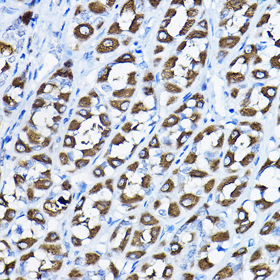 PGLS Rabbit polyclonal antibody