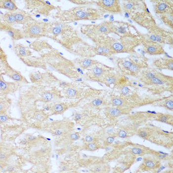 NUDT15 Rabbit polyclonal antibody