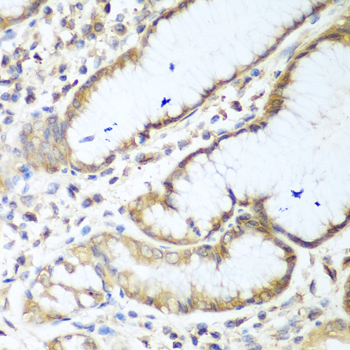 NUDT15 Rabbit polyclonal antibody