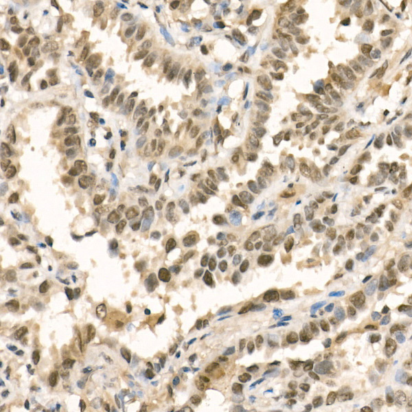 [KD Validated] METTL3 Rabbit polyclonal antibody