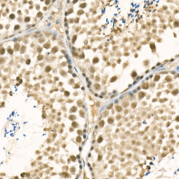 [KD Validated] METTL3 Rabbit polyclonal antibody