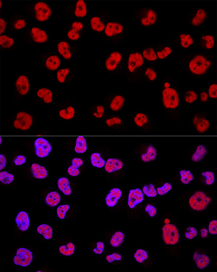 [KD Validated] METTL3 Rabbit polyclonal antibody