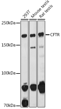 CFTR Rabbit polyclonal antibody