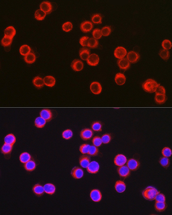 CFTR Rabbit polyclonal antibody