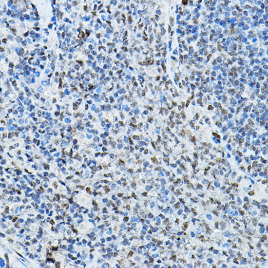 NCOR2 Rabbit polyclonal antibody