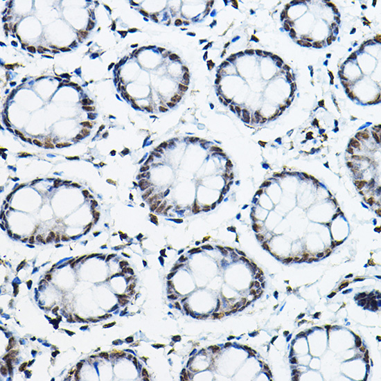 NCOR2 Rabbit polyclonal antibody