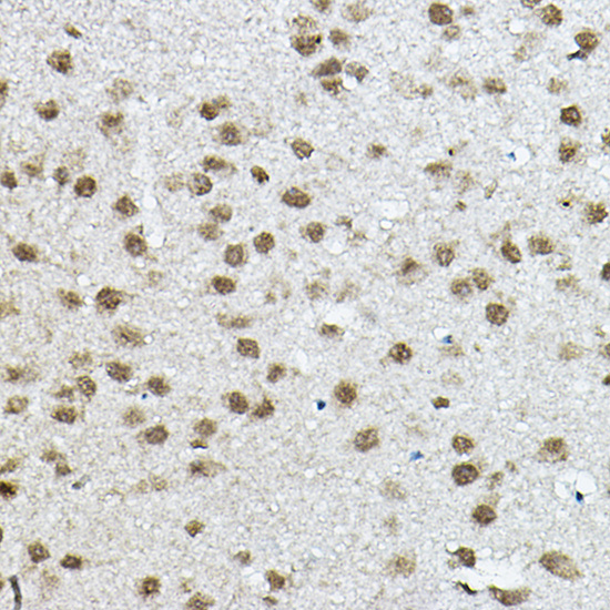 NCOR2 Rabbit polyclonal antibody