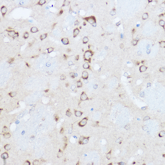 YTHDF3 Rabbit polyclonal antibody