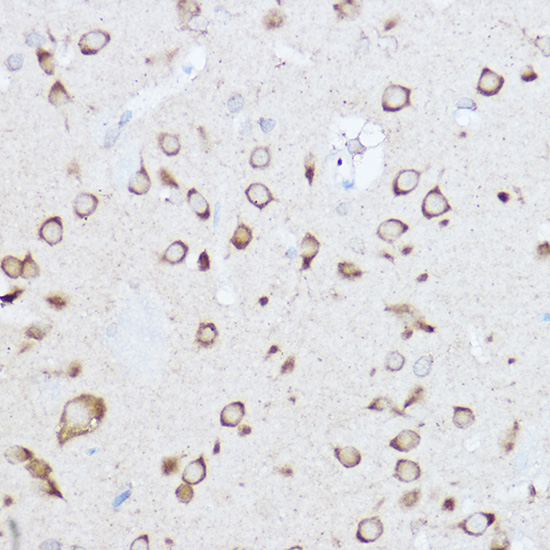 YTHDF3 Rabbit polyclonal antibody