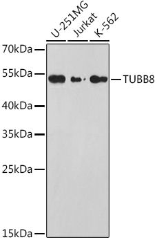 TUBB8 Rabbit polyclonal antibody