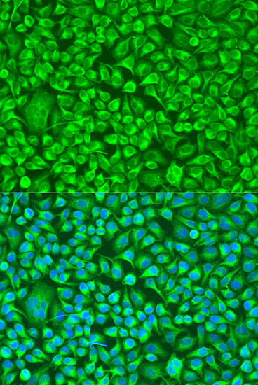 TUBB8 Rabbit polyclonal antibody