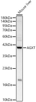 AGXT Rabbit polyclonal antibody