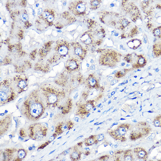 AGXT Rabbit polyclonal antibody