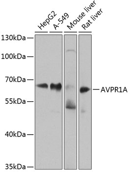 AVPR1A Rabbit polyclonal antibody